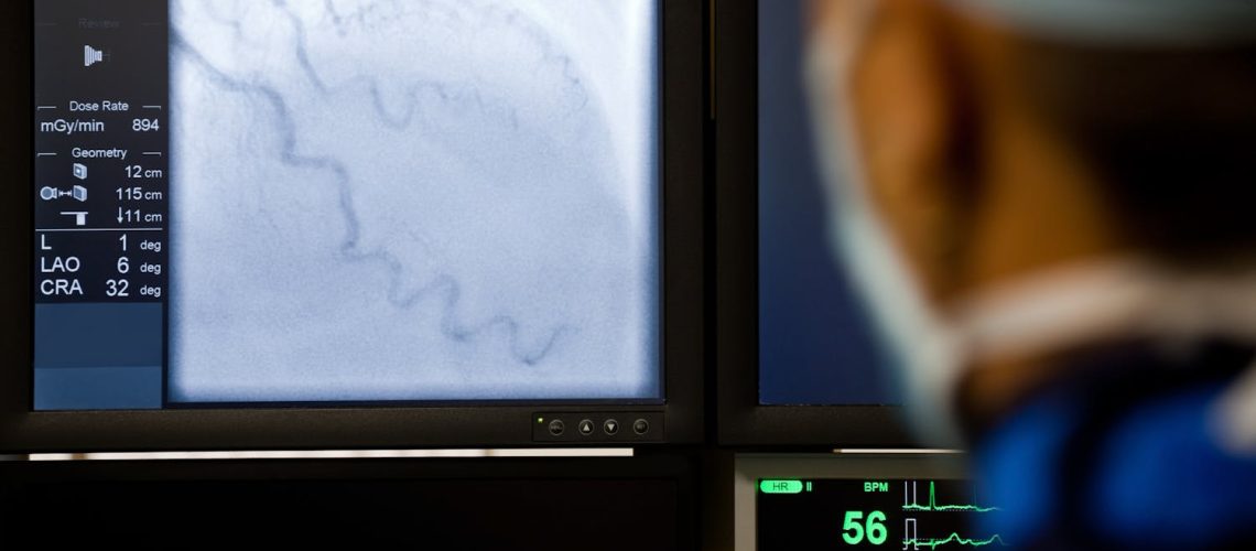 Tout savoir sur l'artériographie